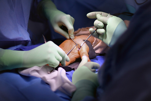 Bhatt Hand Surgery