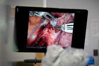 abbas-davinci-surgery-