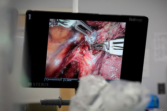 abbas-davinci-surgery-