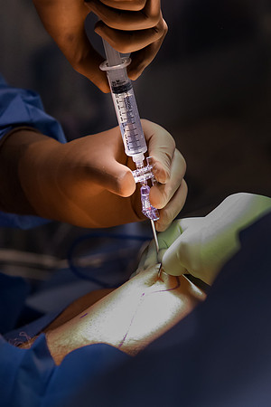 golijanin-surgery