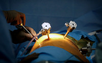 abbas-davinci-surgery-19