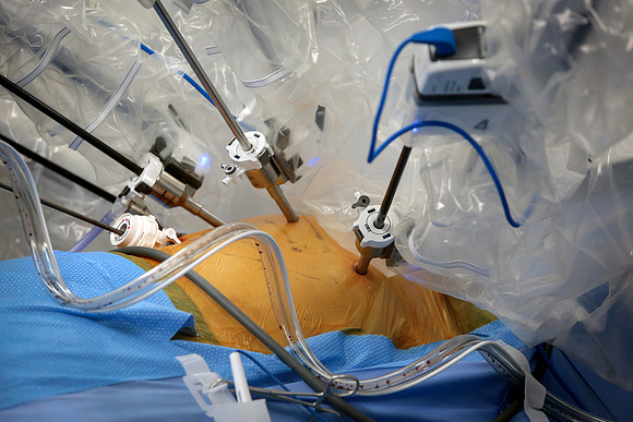 abbas-davinci-surgery-