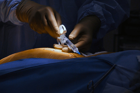 Gokaslan Surgery_