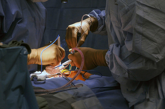 Gokaslan Surgery_